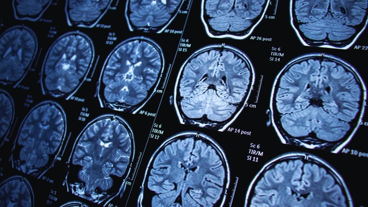 Brain-Computer Interfaces & NeuroTech: From Medical Rehab to Immersive Futures