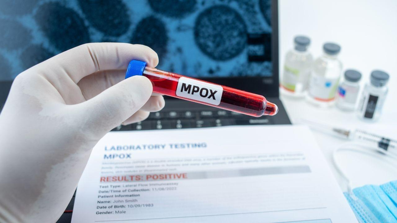 New Mpox Variant Emerges in the Netherlands: Public Health Alert Issued